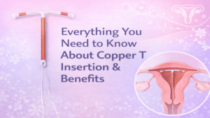 Everything You Need to Know About Copper T Insertion & Benefits